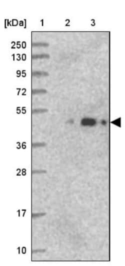 ARMC6 Antibody, Novus Biologicals 0.1mL; Unlabeled:Antibodies, Polyclonal